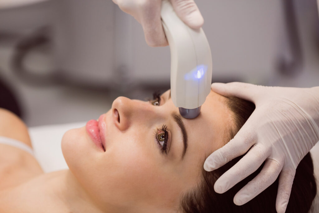 Microneedling-Treatment