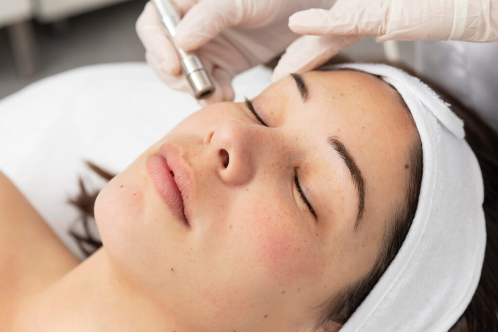 microneedling-diva