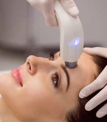 Microneedling-Treatment